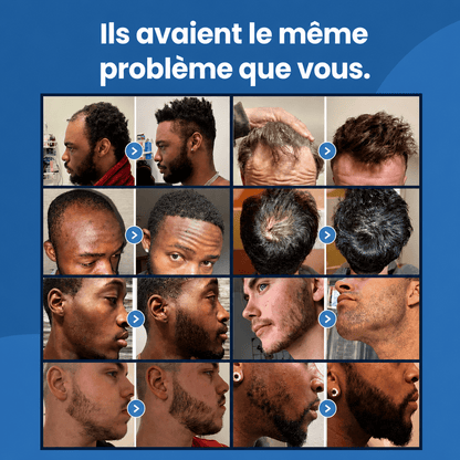 Sérum Croissance Pour Cheveux 2